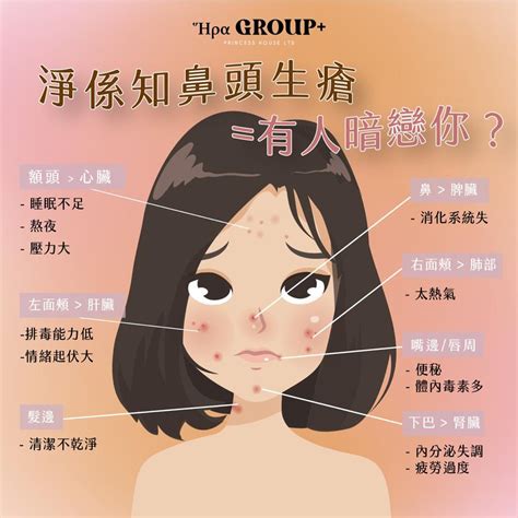 鼻翼生暗瘡面相|暗瘡位置｜面相分析入門：人不可以貌相？相由心生